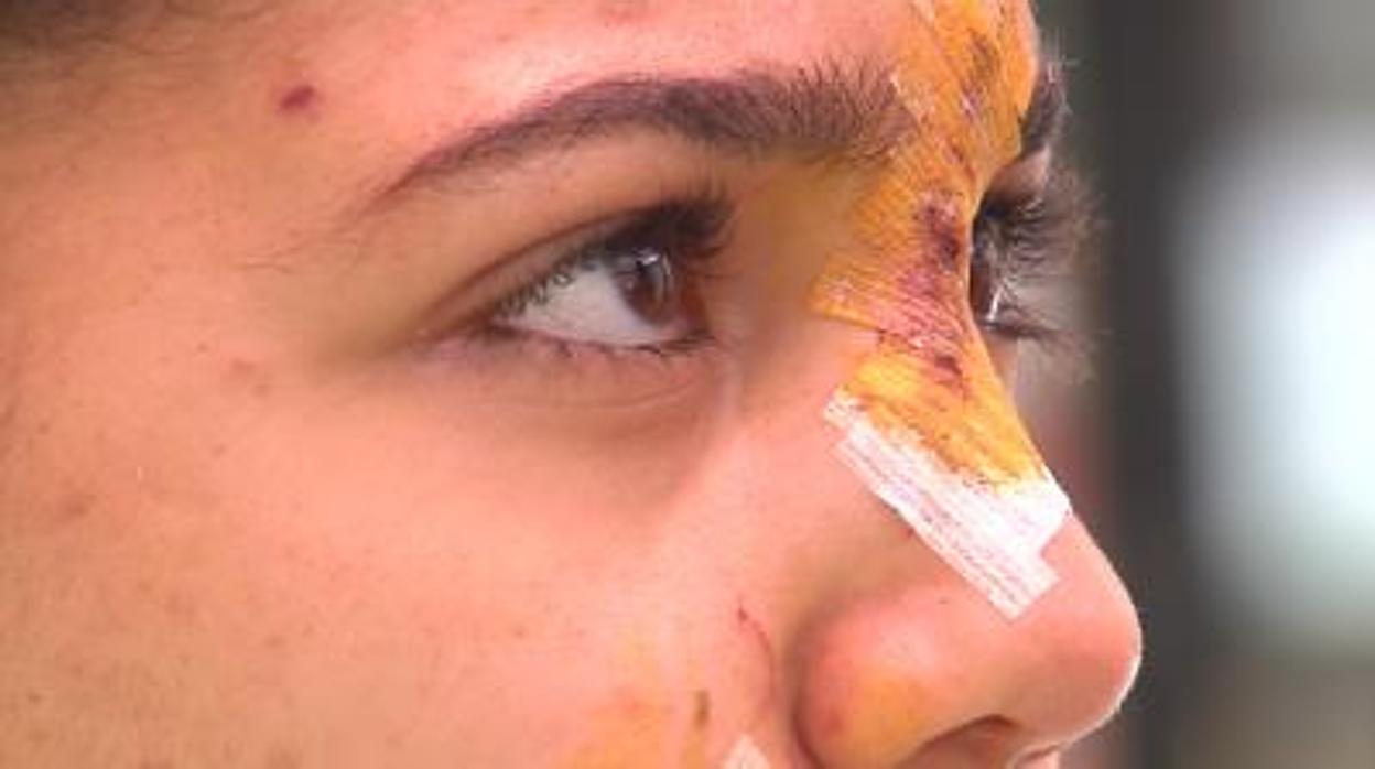 Estado del escaparate tras la agresión