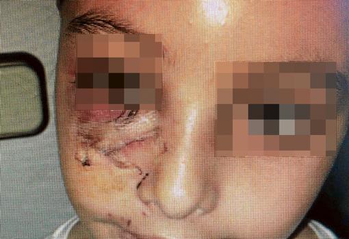 Un perro peligroso ataca a una niña en una fiesta de Comunión en Sevilla