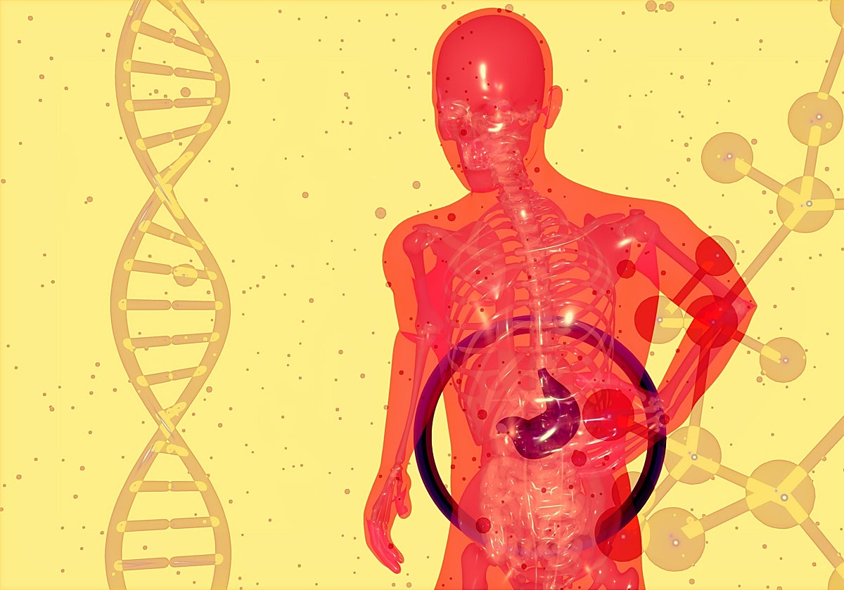 ¿Cuáles son los síntomas del hígado graso no alcóholico?
