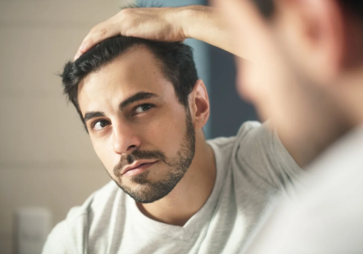 Perder pelo es uno de los mayores temores de muchos hombres
