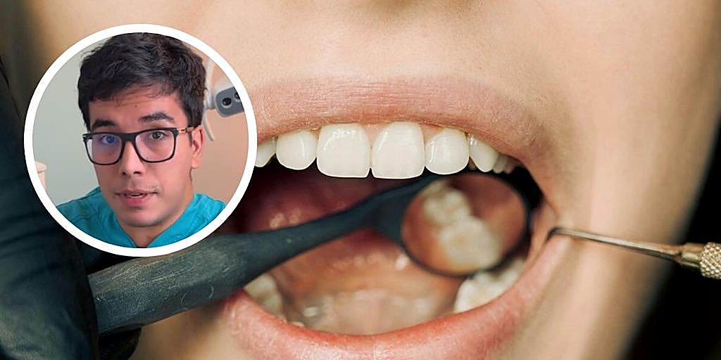 Matias Mathijsen, odontólogo: «La pulpa dental es lo que te duele y palpita cuando te hacen una endodoncia»