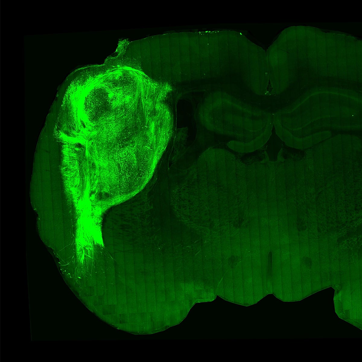 Insertan 'minicerebros' humanos en ratas y logran cambiar su comportamiento