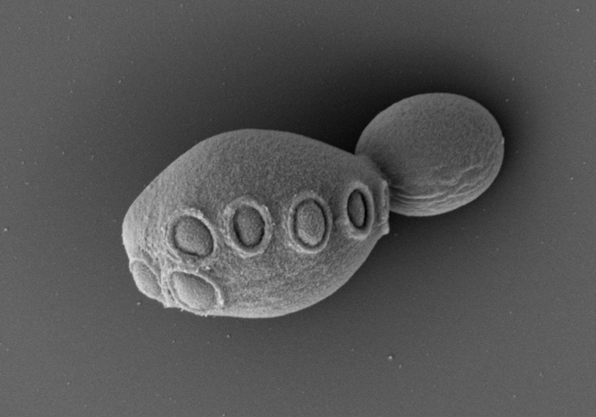 La imagen muestra una célula de levadura con cerca del 30% de ADN sintético que, a pesar de ello, creció y se multiplicó con normalidad