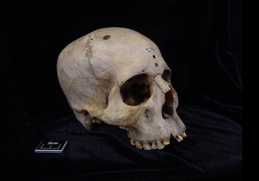 Un egipcio de hace 4.000 años, el primer paciente con cáncer sometido a cirugía