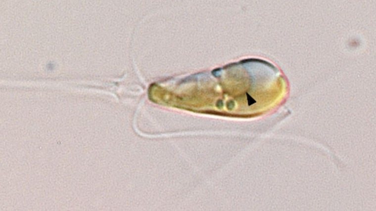 Una imagen de microscopio óptico muestra la alga haptofítica marina Braarudosphaera bigelowii con una flecha negra que apunta al orgánulo nitroplasto