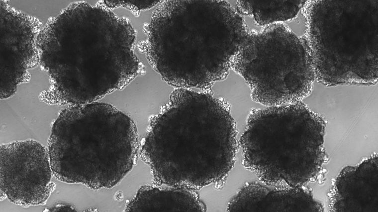 Organoides cerebrales humanos