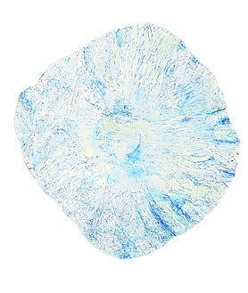 Imagen secundaria 2 - 'Arriba, detalle de 'El aspirante', de Adrià Miko. Abajo. Abajo a la izquierda, fragmento de 'Felipe III, El Piadoso', de Paloma Gaitán. Abajo a la derecha, obra de Mariángeles Blanco