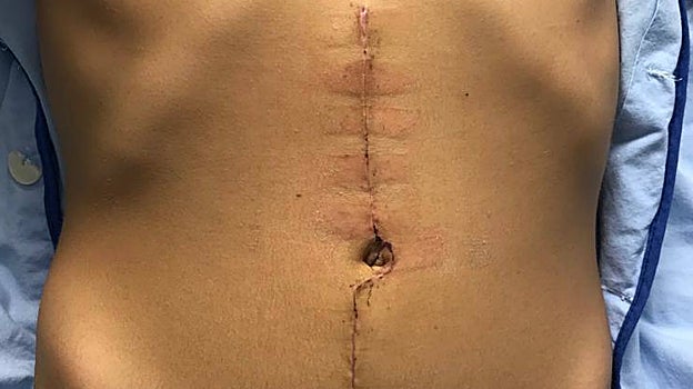 Estaba deshidratado y con una perforación en el sistema digestivo