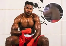 Muere un boxeador después de estar tres semanas en coma inducido por un KO en un combate