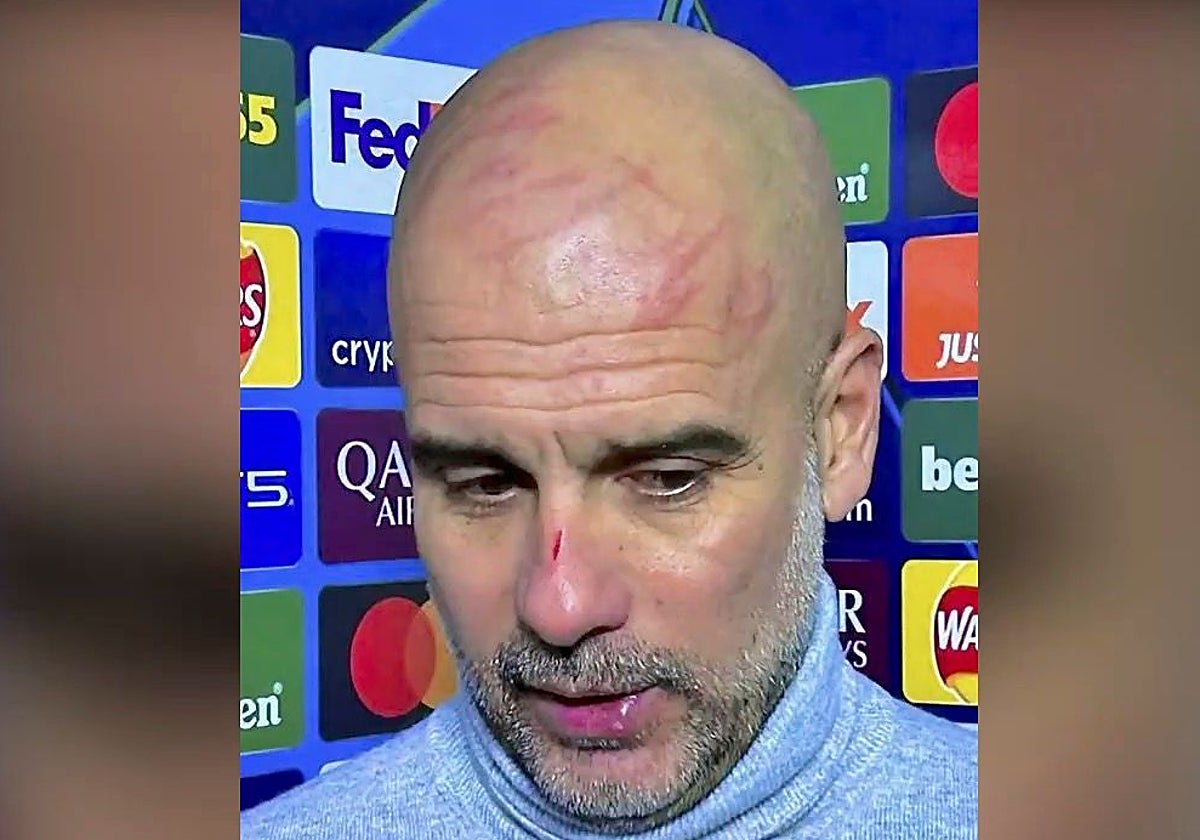 Pep Guardiola atiene a las televisiones con la cabeza llena de arañazos