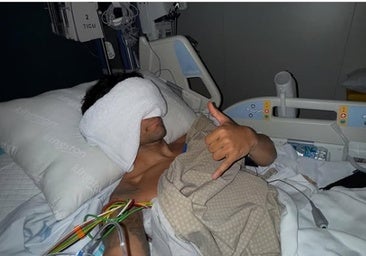 La mala suerte persigue a Jorge Martín: neumotórax, once costillas rotas