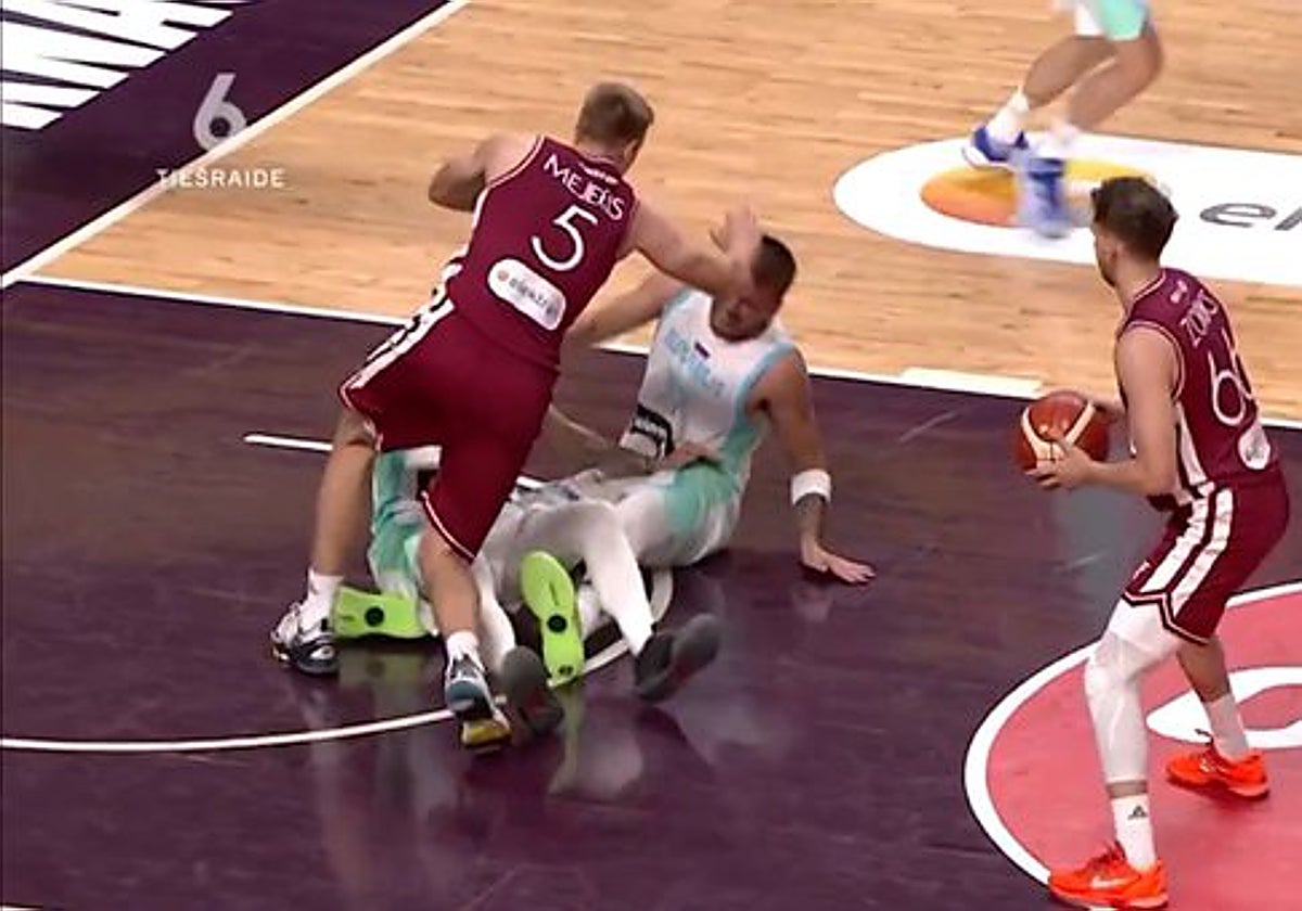 Doncic sufrió un fuerte golpe con su selección