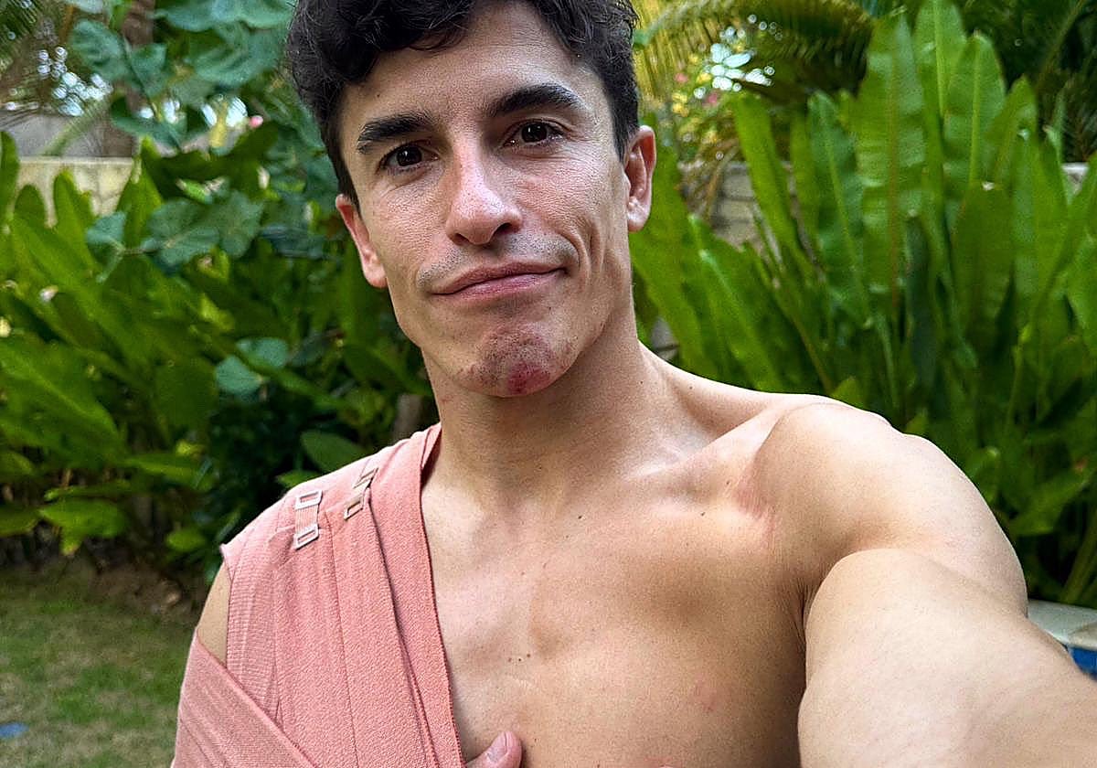 Marc Márquez, con el brazo en cabestrillo tras el accidente