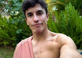 Marc Márquez, con el brazo en cabestrillo tras el accidente