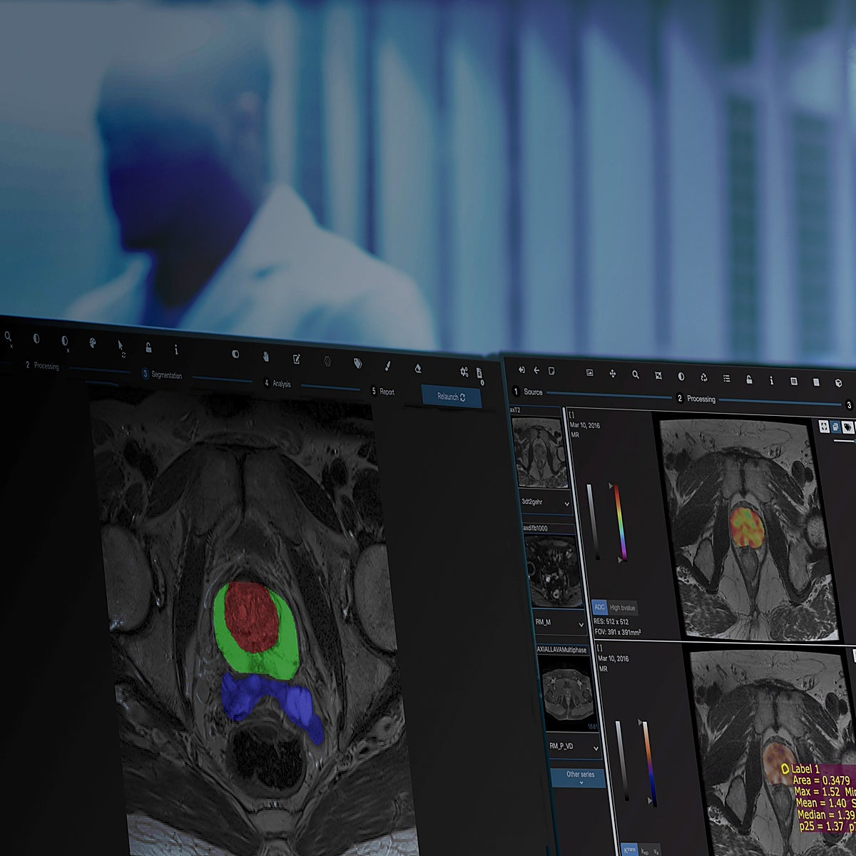 Los algoritmos que revelan los rastros de enfermedad ocultos en las imágenes