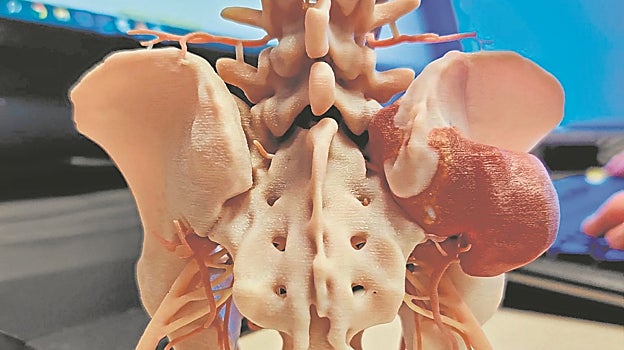 Uno de los modelos de Biotech Digital Solutions