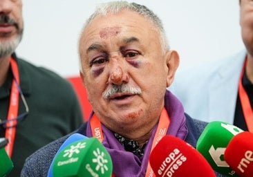 Pepe Álvarez explica por qué apareció con la cara herida en un acto de UGT en Castilla y León