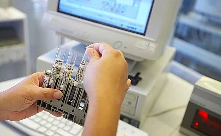 Canarias alcanza los 78 casos de viruela del mono