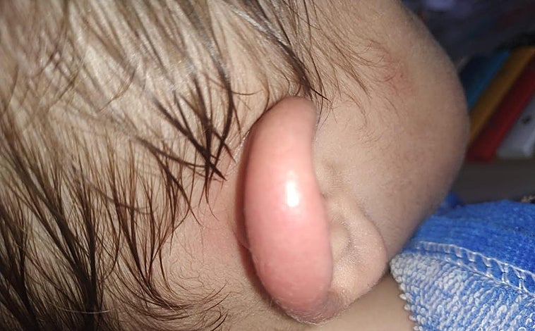 Imagen principal - Vecinos con las consecuencias de la presencia de la mosca negra en sus barrios