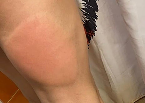 Imagen secundaria 1 - Vecinos con las consecuencias de la presencia de la mosca negra en sus barrios