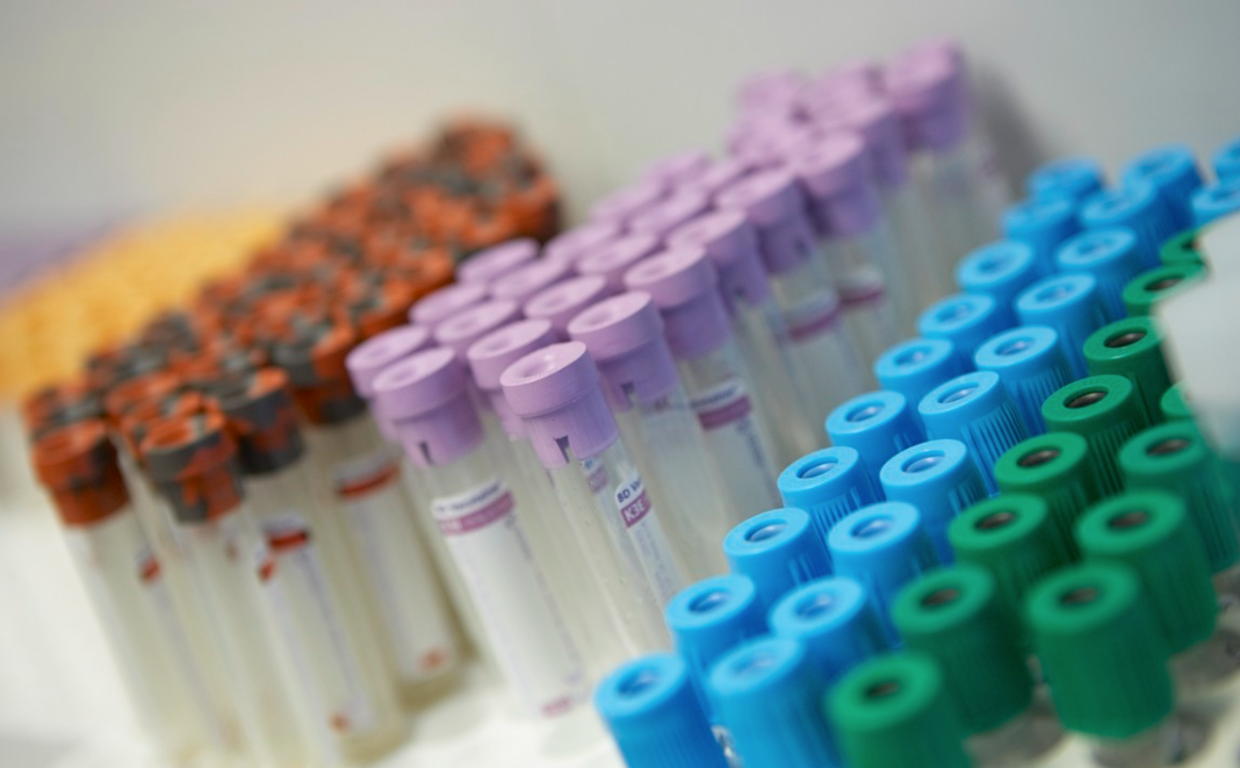 Tubos de muestras en un centro del Servicio Canario de Salud
