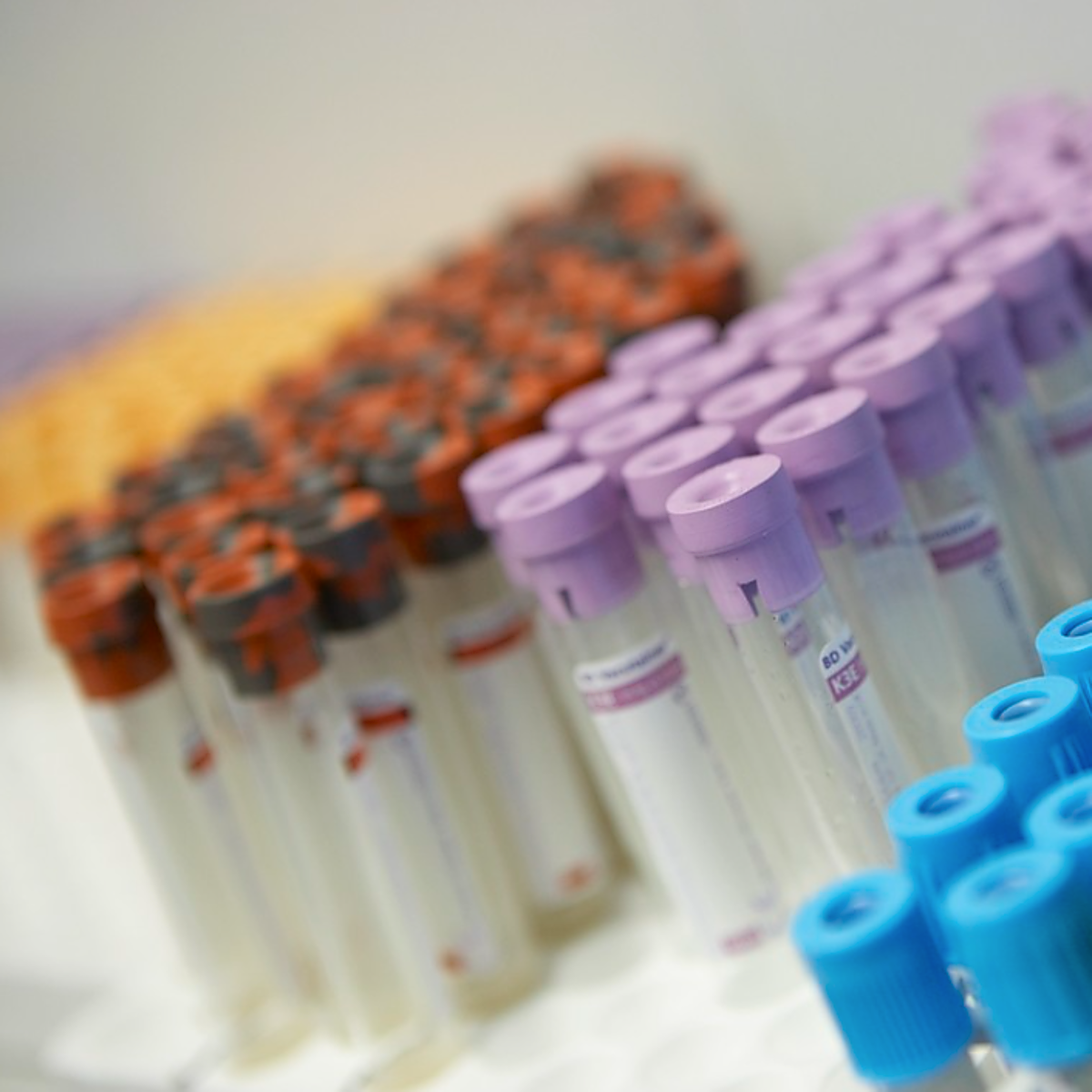 La viruela del mono en Canarias sigue sumando casos y ya supera el centenar