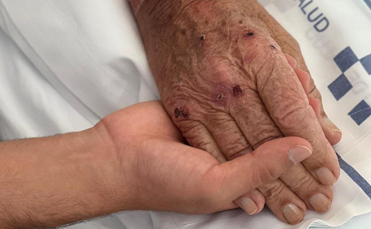 Foto de archivo de un anciano hospitalizado en el Servicio Canario de Salud