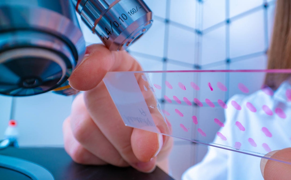 Una muestra de las pruebas de laboratorio de los cribados