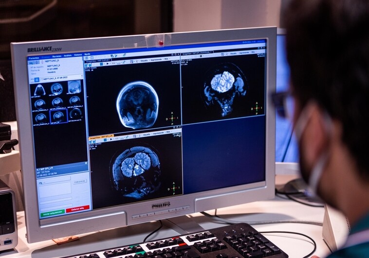 Valencia abre el principal centro de datos e imagen médica para la lucha contra el cáncer en Europa