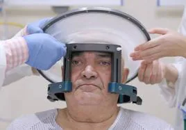El hospital Reina Sofía incorpora el primer equipo en Andalucía para tratar el temblor esencial y el del Parkinson