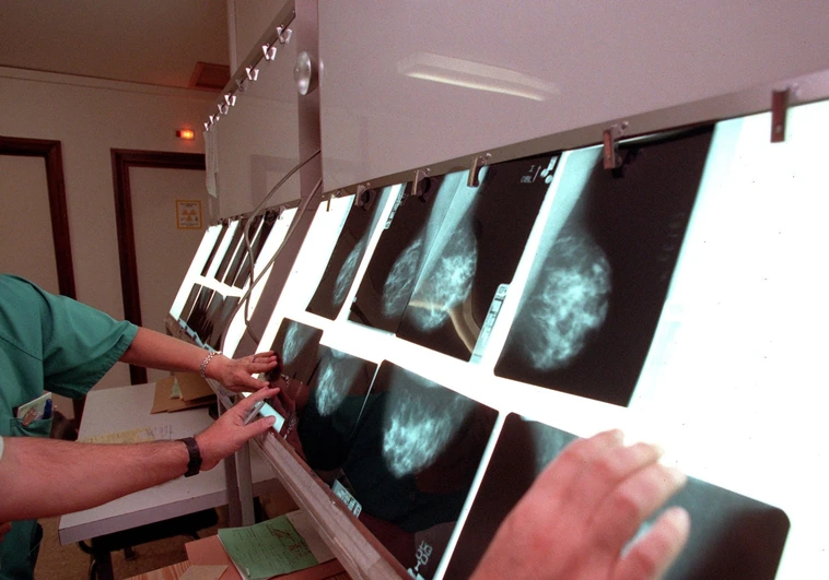 La Junta autoriza un gasto de 23 millones para hacer 575.000 mamografías en Castilla-La Mancha hasta 2028