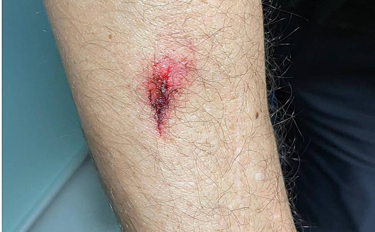 Imagen principal - En la imagen, piedras y palos intervenidos tras la protesta, que dejó varios heridos, entre ellos agentes de la Policía Nacional desplazados al lugar