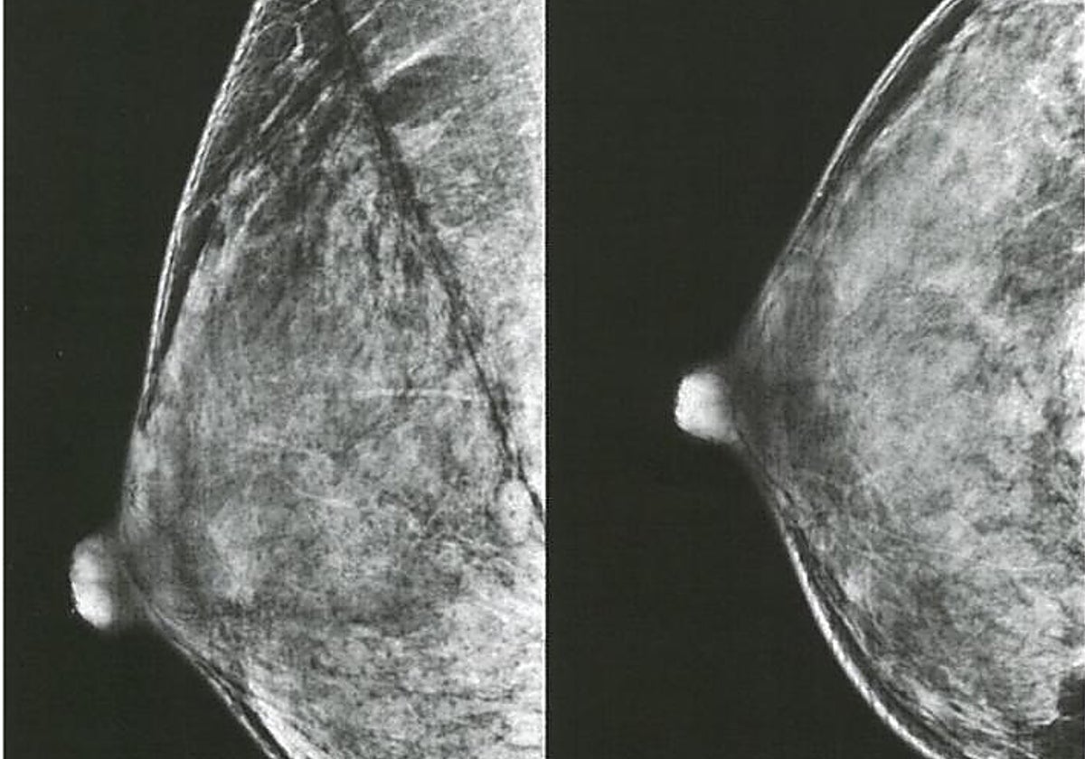 Una mamografía en una imagen de archivo