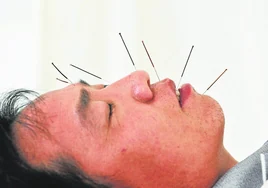 Denuncian una plaga de unos 350 centros de acupuntura ilegales en la Comunidad de Madrid