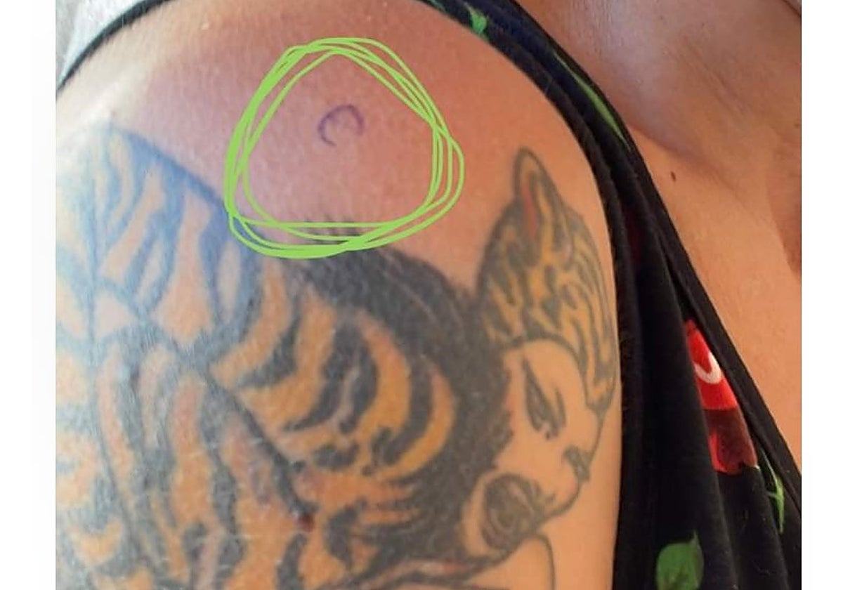 Imagen de la mujer 'tatuada' por el encargado de un restaurante