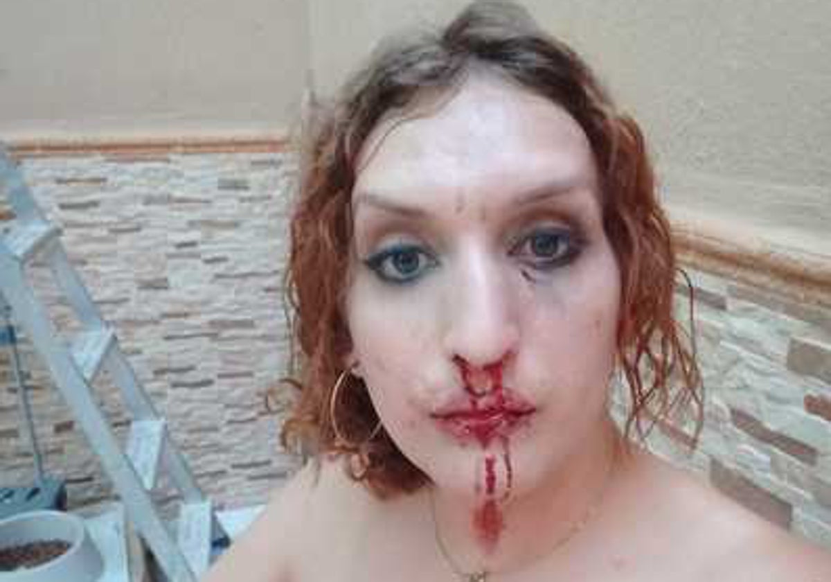 La mujer transexual supuestamente agredida, en imagen facilitada por su familia