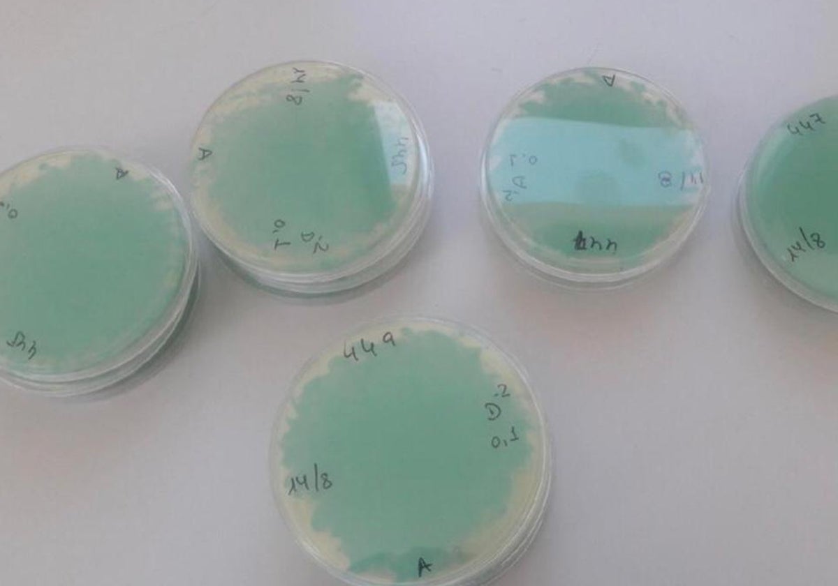 Cultivos de las bacterias de listeria en una imagen de archivo