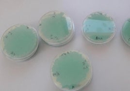 Salud decreta alerta alimentaria por listeria en embutidos de Granada vendidos en toda Andalucía
