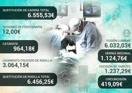 Lo que paga el Servicio Andaluz de Salud a las clínicas concertadas: 964 euros por catarata, 1.200 por hernia...