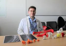 Impresión 3D para  las intervenciones en traumatología en el hospital de Ciudad Real