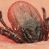 Confirman un caso de fiebre hemorrágica de Crimea-Congo en un hombre de avanzada edad en Salamanca