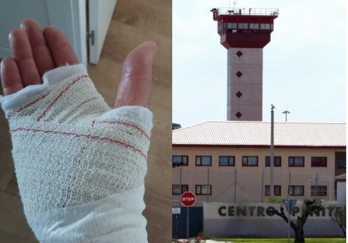 Mano lesionada de un funcionario atacado por el presidiario y a la derecha, el centro penitenciario de Villena (Alicante).