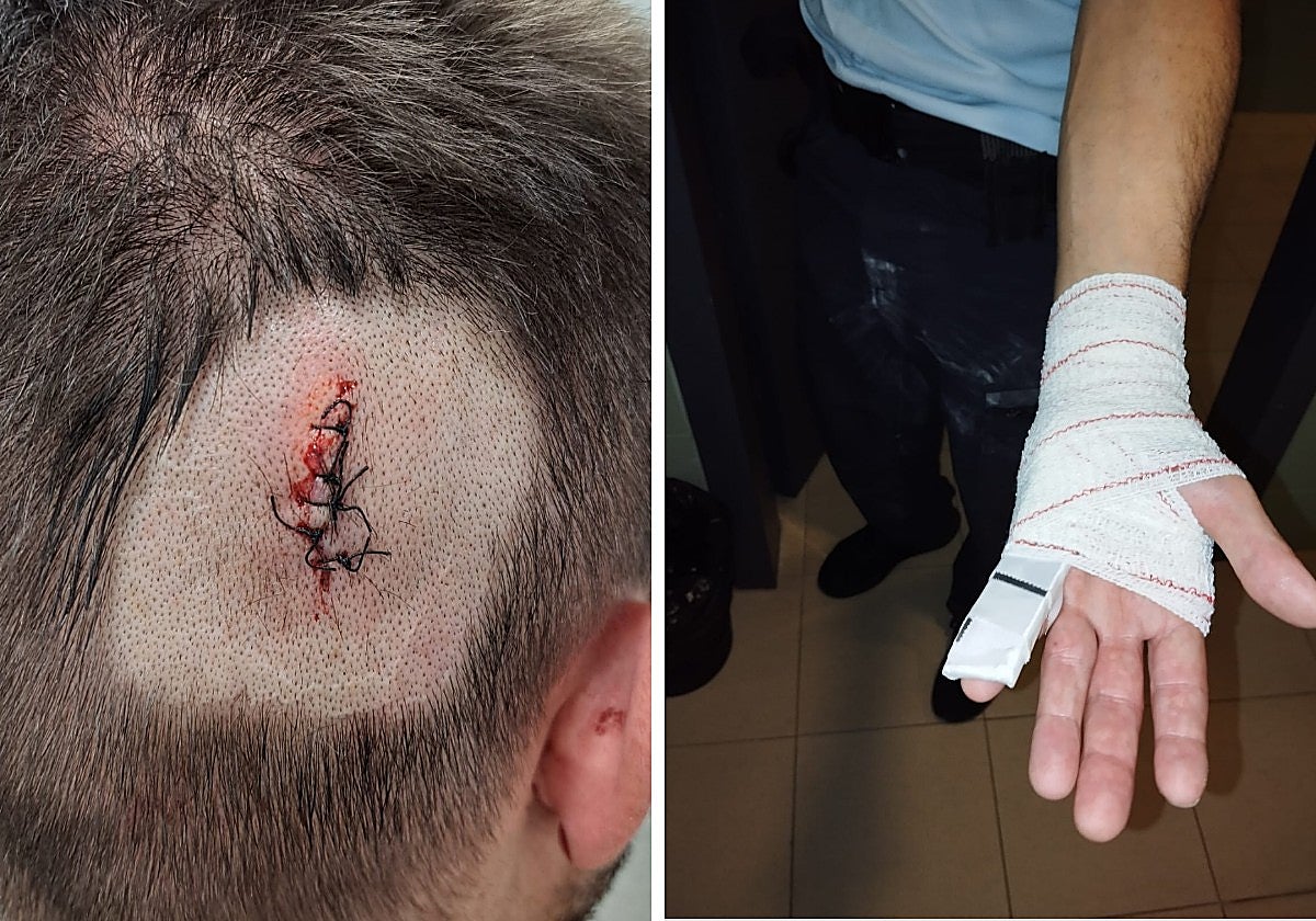 Dos de los funcionarios agredidos por un preso