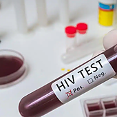 El TSJC absuelve a una mujer denunciada por contagiar de VIH a su pareja en Tenerife