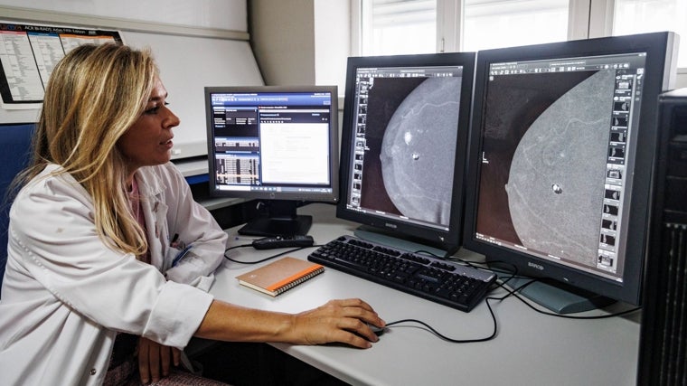 Imagen de la mama con el tumor (izq.), y tras el tratamiento, sin rastro del cáncer (dcha)