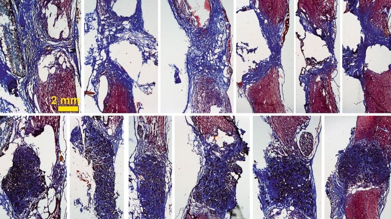 Los tejidos de nuevo crecimiento 'colonizan' el espacio de la lesión en la médula espinal gracias a la espuma creada en el ICMM-CSIC en colaboración con el HNP.