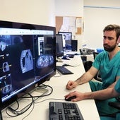 La Fe de Valencia realiza una terapia pionera en España para tratar la compresión medular metastásica