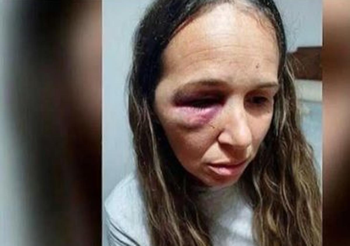Eloisa tras la brutal paliza