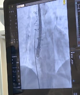 Imagen secundaria 2 - La operación pionera en España 