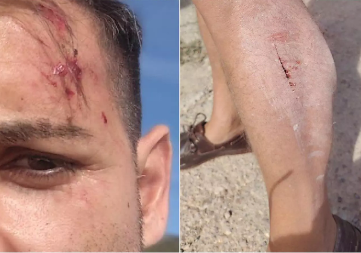 Imagen de los periodistas agredidos por ganaderos en la localidad castellonense de Alcalà de Xivert